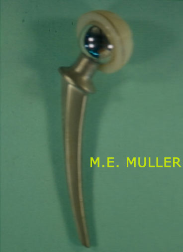 M-E-MULLER